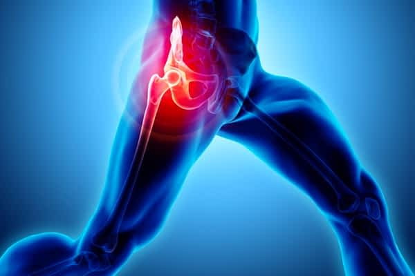 Infiammazione anca e l’osteopatia